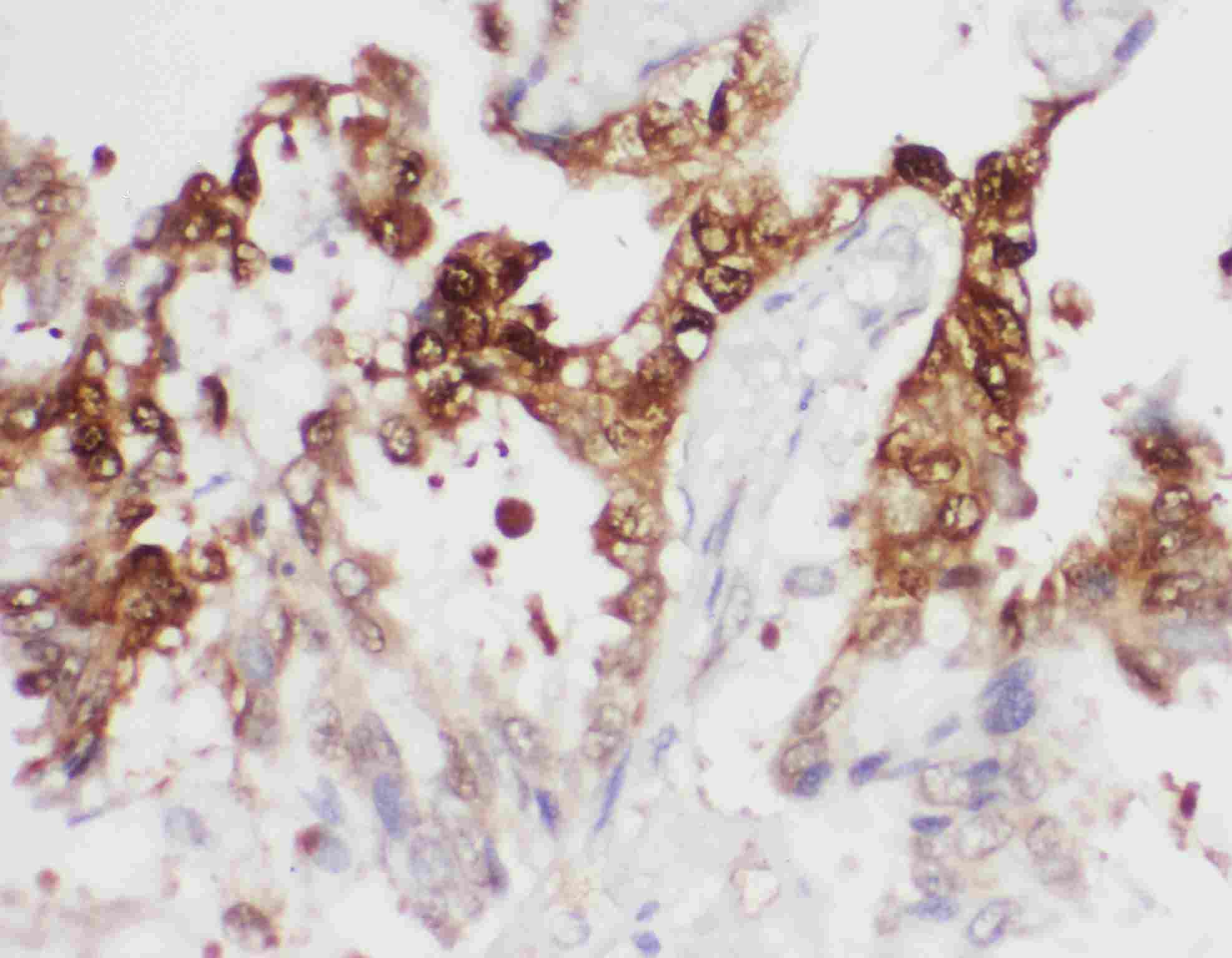 IHC - Anti-PGK1 Antibody ABO11352